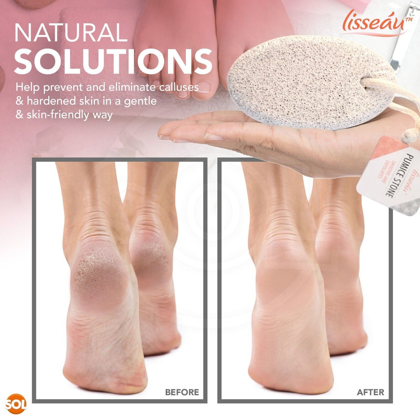 2pk Natural Pumice Stone For Feet | Hard Dead Skin Callus Remover Exfoliate Foot
