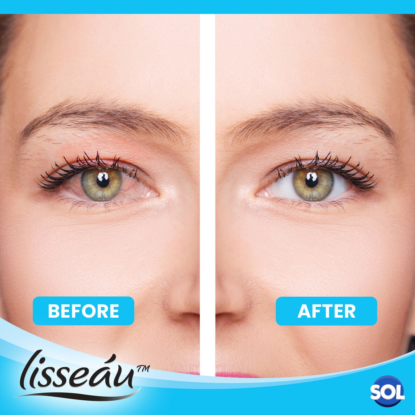 Dry Eye Spray 15ml Hydrating Mist for Irritated Eyes | 2 Pack