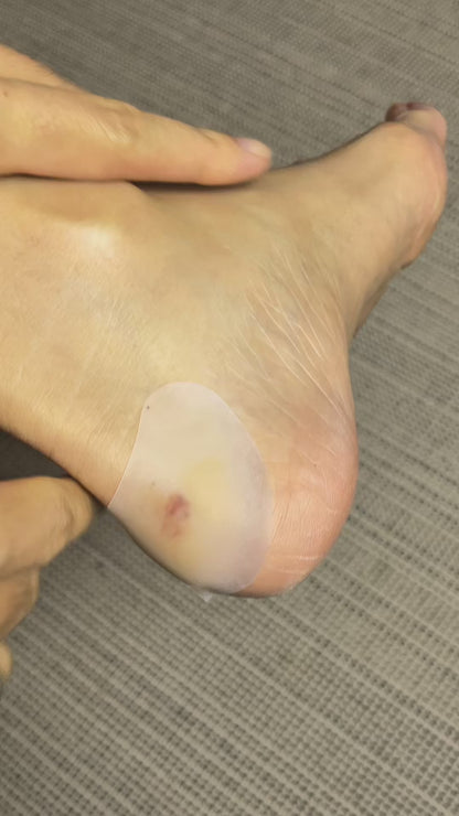 Hydrocolloid Gel Blister Plasters | Heel Toe Protection | 24 Pack
